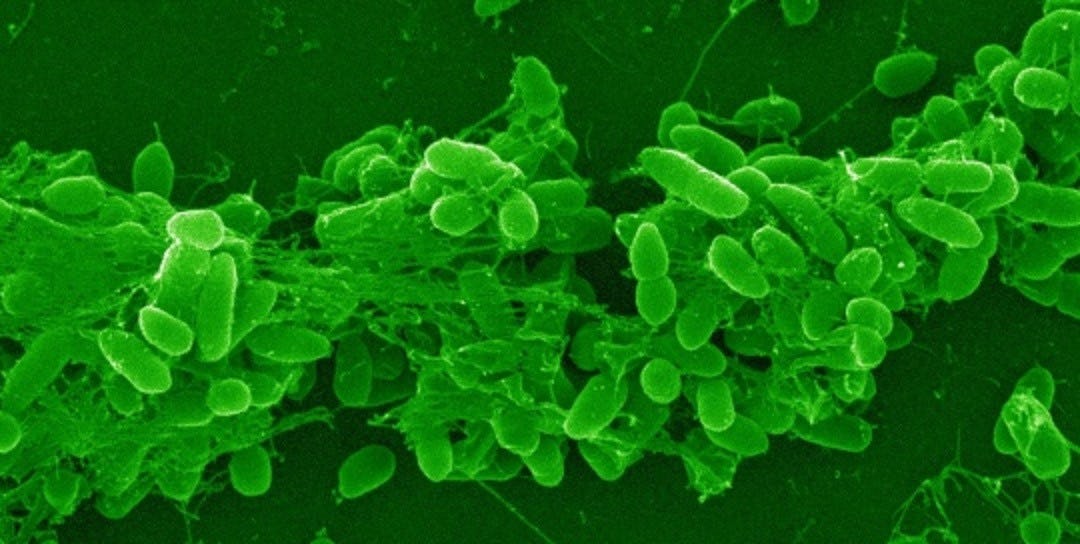 Microscope image of Pseudomonas aeruginosa bacteria.
