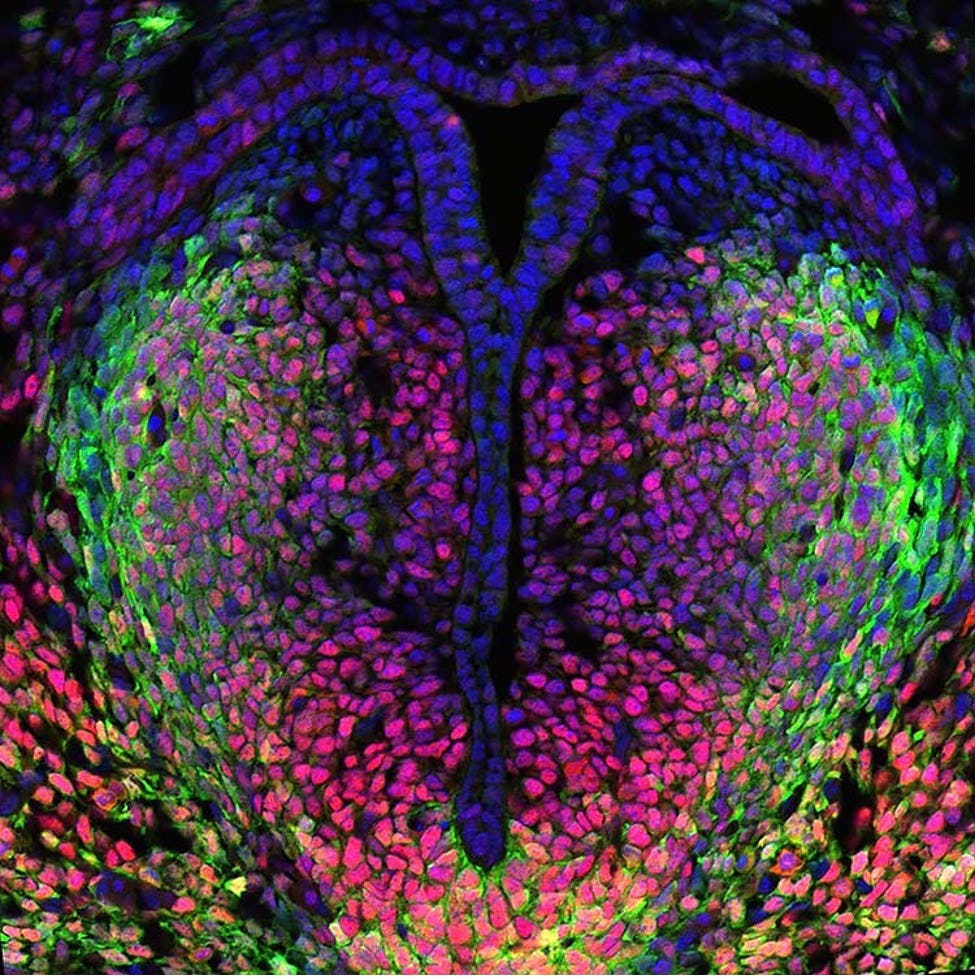 Hedgehog signaling responses during organogenesis