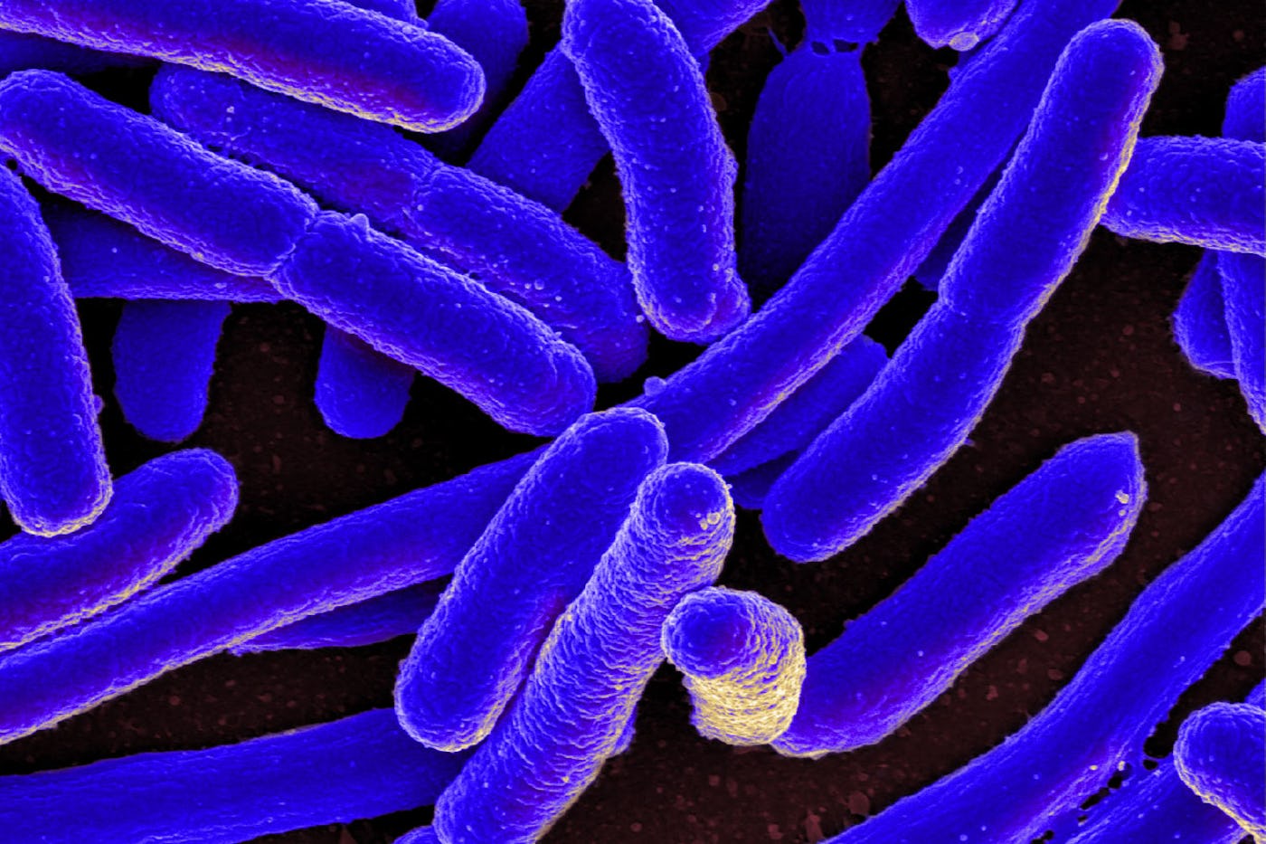 Microscopic images of E.coli bacteria.