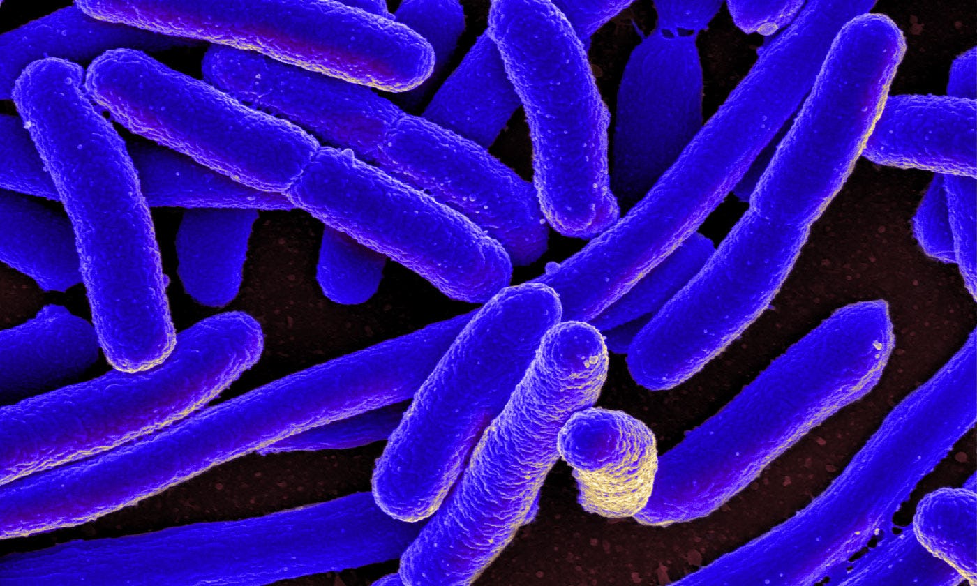 Microscopic images of E.coli bacteria.