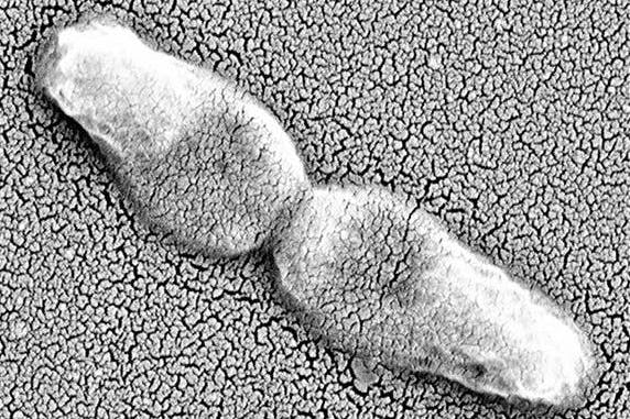 k-pneumoniae-no-labels-thumb.jpeg
